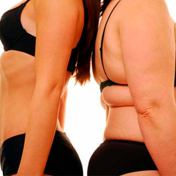 Alcachofa para bajar de peso