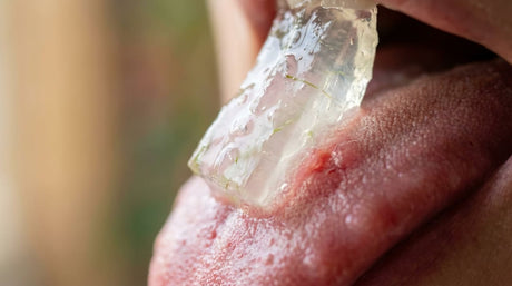 Fuegos en la Lengua - Remedios Caseros que Alivian Ya